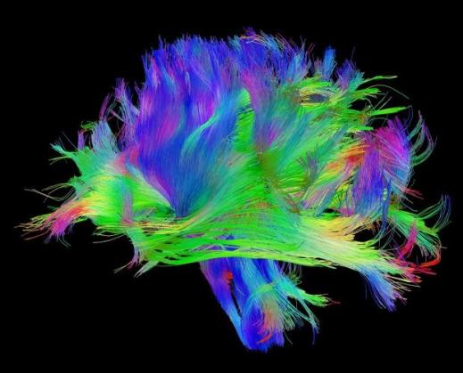 3024528-slide-s-brain-03