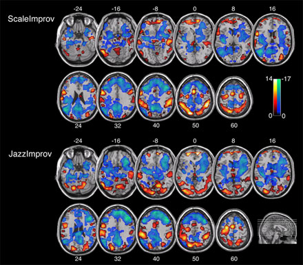 fmri