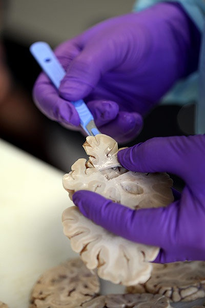 He-scalpels-out-little-se-004