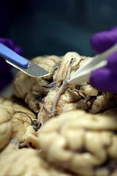 The-folds-and-ridges-and--003