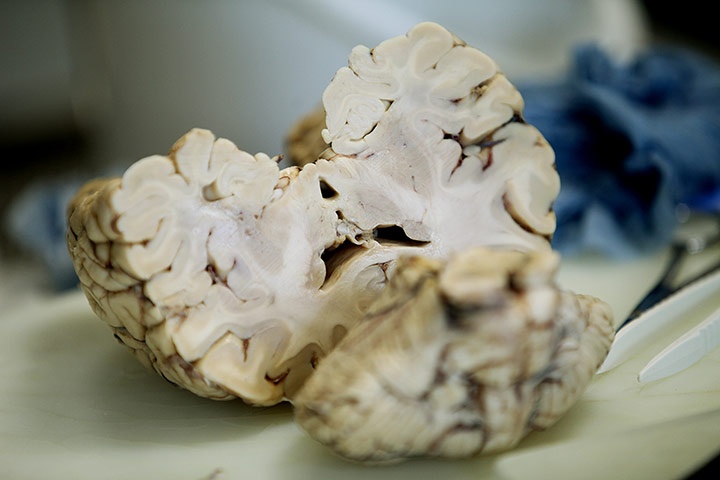 These-are-still-patients--006