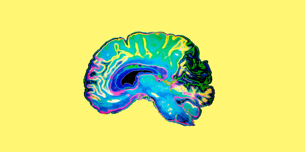 Coloured MRI Scan Of Human Brain