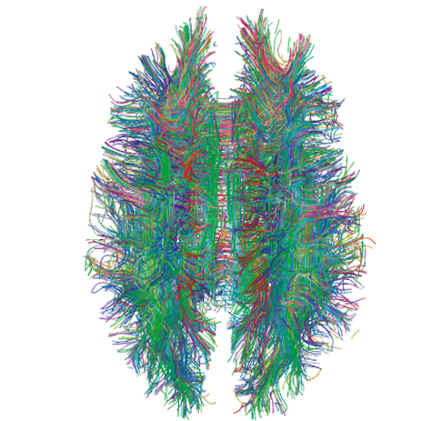 White_Matter_Connections_Obtained_with_MRI_Tractography