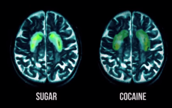 Azúcar y Cocaína en el Cerebro