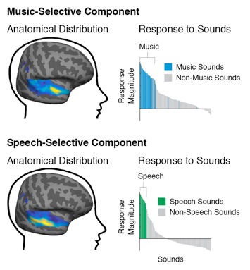 Areas de la Música y Áreas del Habla (http://mcdermottlab.mit.edu/svnh/Natural-Sound/Overview.html)