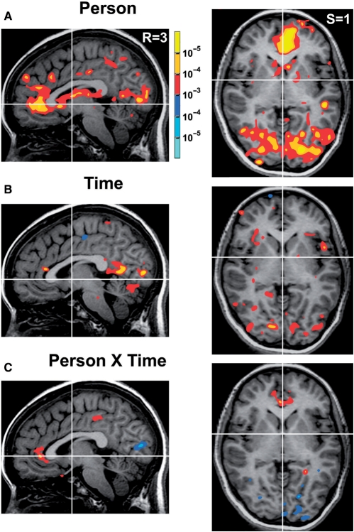 Imágenes de los Resultados