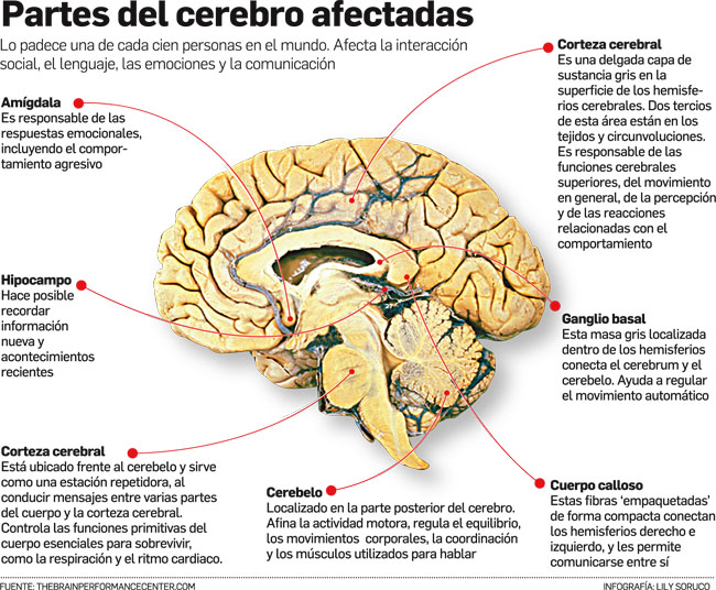 Partes del Cerebro afectadas por el Trastorno del Espectro Autista