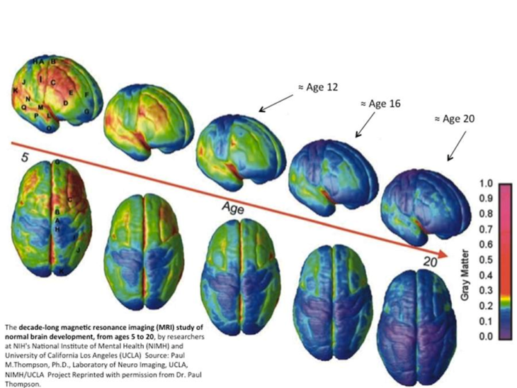 Evolución de la materia gris del cerebro