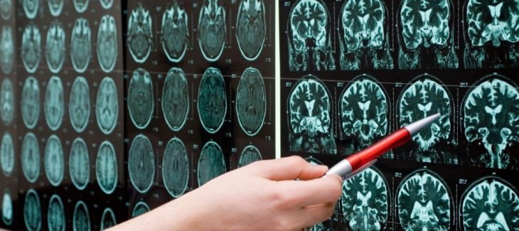 brain-scans-point-1024x456